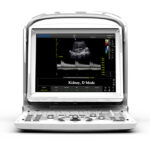 Υπέρηχος B&W Chison ECO 3 Expert + doppler - οθόνη