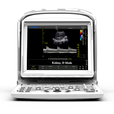 Υπέρηχος B&W Chison ECO 3 Expert + doppler - οθόνη