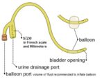 foleycatheter