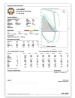 MIR Spirolab New spirometer with reusable turbine