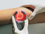 VeinSpy vein detector