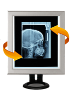 Weiko SLIM single-position LED tabletop fluoroscope