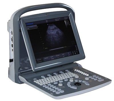 Ultrasound B&W Chison ECO 1