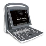Ultrasound B&W Chison ECO 2 + doppler