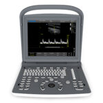 Ultrasound B&W Chison ECO 2 + doppler - front view