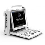 Υπέρηχος B&W Chison ECO 3 Expert + doppler