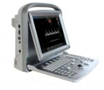 Υπέρηχος Colour Chison ECO 5 + doppler
