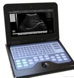 Υπέρηχος Contec CMS 600P2 οθόνη