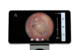Riester RCS-100 Otoscope with Display