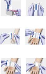 Transparent adhesive patch Hydrofilm® roll Hartmann