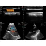 SonoStar-UProbe-C5PL-Ultrasound-Scanner-extra-big-356-765