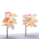 csm_139062_HeineScientific_Bandscheibenmodell_4_c0f7fe201d