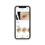 csm_K-000.00.001-HEINE-Dermatoscope-DERM-App-iPhone-10-Silver_additional3_07fc421d9f