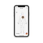 csm_K-000.00.001-HEINE-Dermatoscope-DERM-App-iPhone-10-Silver_additional4_3a2dd60b42