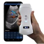 sonostar_c5pl_wireless_handheld_ultrasound_diagnostic_scanner
