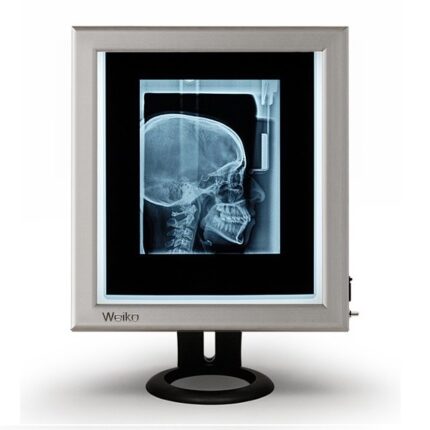 Weiko SLIM single-position LED tabletop fluoroscope