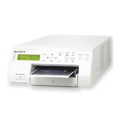 Εκτυπωτής-υπερήχων-Sony-UP-25MD-1