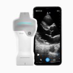 Portable ultrasound VSCAN AIR SL