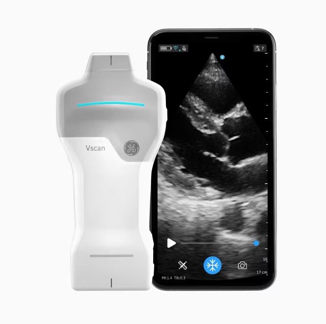 Portable ultrasound VSCAN AIR SL Portable ultrasound VSCAN AIR SL