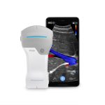 Portable ultrasound VSCAN AIR SL